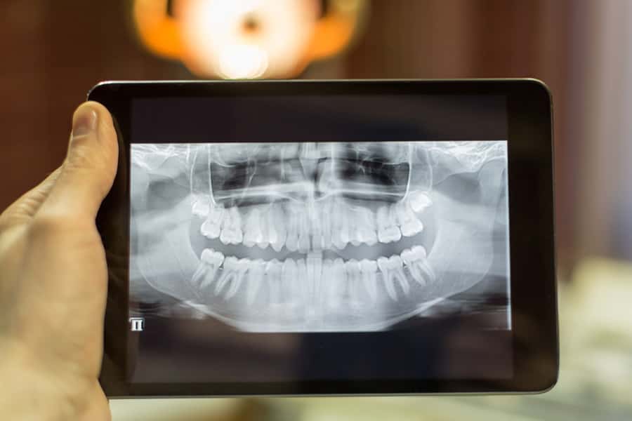 Digital Radiography in Austin, TX