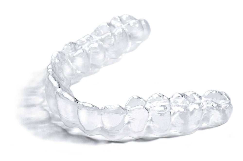 Invisible Braces in Austin, TX